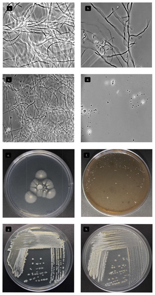 Characterization Streptomyces sp. STCH565-A.