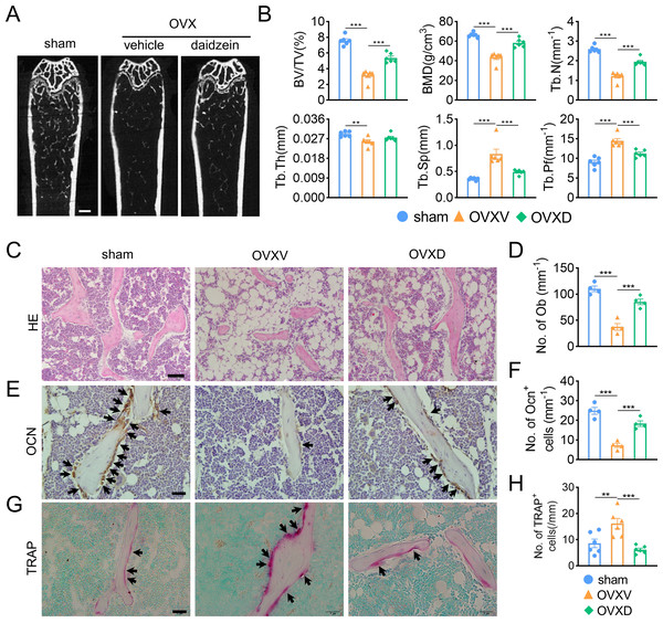 Cav-1 is involved in OVX-induced osteoporosis and osteogenesis suppression.