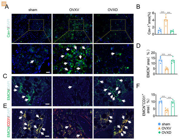 Daidzein alleviates OVX-induced decreases in H-type vessels in cancellous bone.