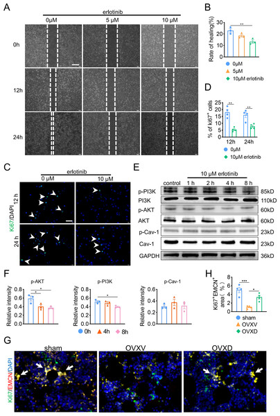 Cav-1 inhibits migration and proliferation of BMECs through suppressing EGFR/AKT/PI3K signaling.