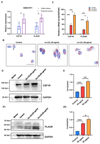 The expression levels of CSF1R and PLAUR in the GSE41571 and the ox-LDL-induced macrophage.