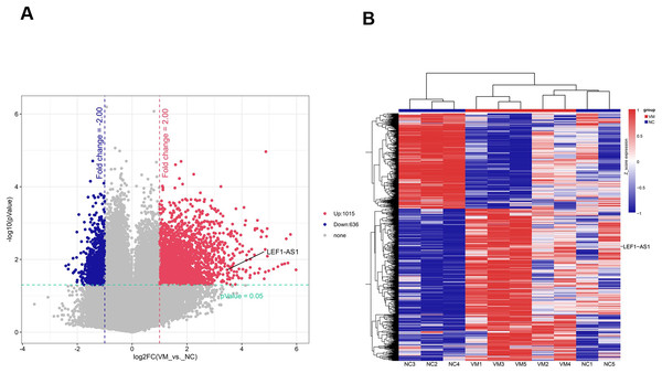 Screened candidate lncRNA biomarkers through chip and bioinformatics analyses.