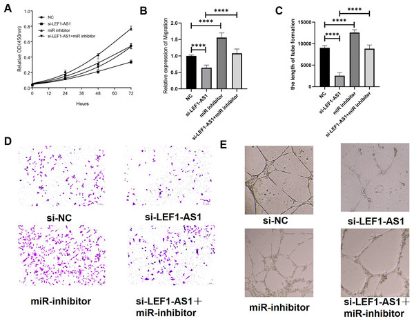 (A) LEF1-AS1 silencing had an inhibitory effect on cell proliferation, which was weakened by miR inhibitor, while the inhibition of Mir-489-3p expression enhanced cell proliferation. (B) LEF1-AS1 silencing had an inhibitory effect on cell migration, which was weakened by a miR inhibitor. The expression inhibition of Mir-489-3p enhanced the cell migration, (C) LEF1-AS1 silencing had an inhibitory effect on cell angiogenesis, which was weakened by a miR inhibitor, while the inhibition of Mir-489-3p expression enhanced the cell angiogenesis, (D) transwell migration maps of the four groups of cells: NC, si-LEF1-AS1, miR inhibitor, and si-LEF1-AS1+miR inhibitor. (E) NC, si-LEF1-AS1, miR inhibitor, and si-LEF1-AS1+miR inhibitor groups, in vitro angiogenesis of the four groups of cells. ****P < 0.0001.