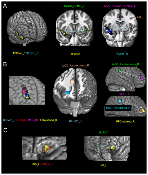 The altered FC between different sub-clusters with the whole brain in the SCI group compared with the NC group.