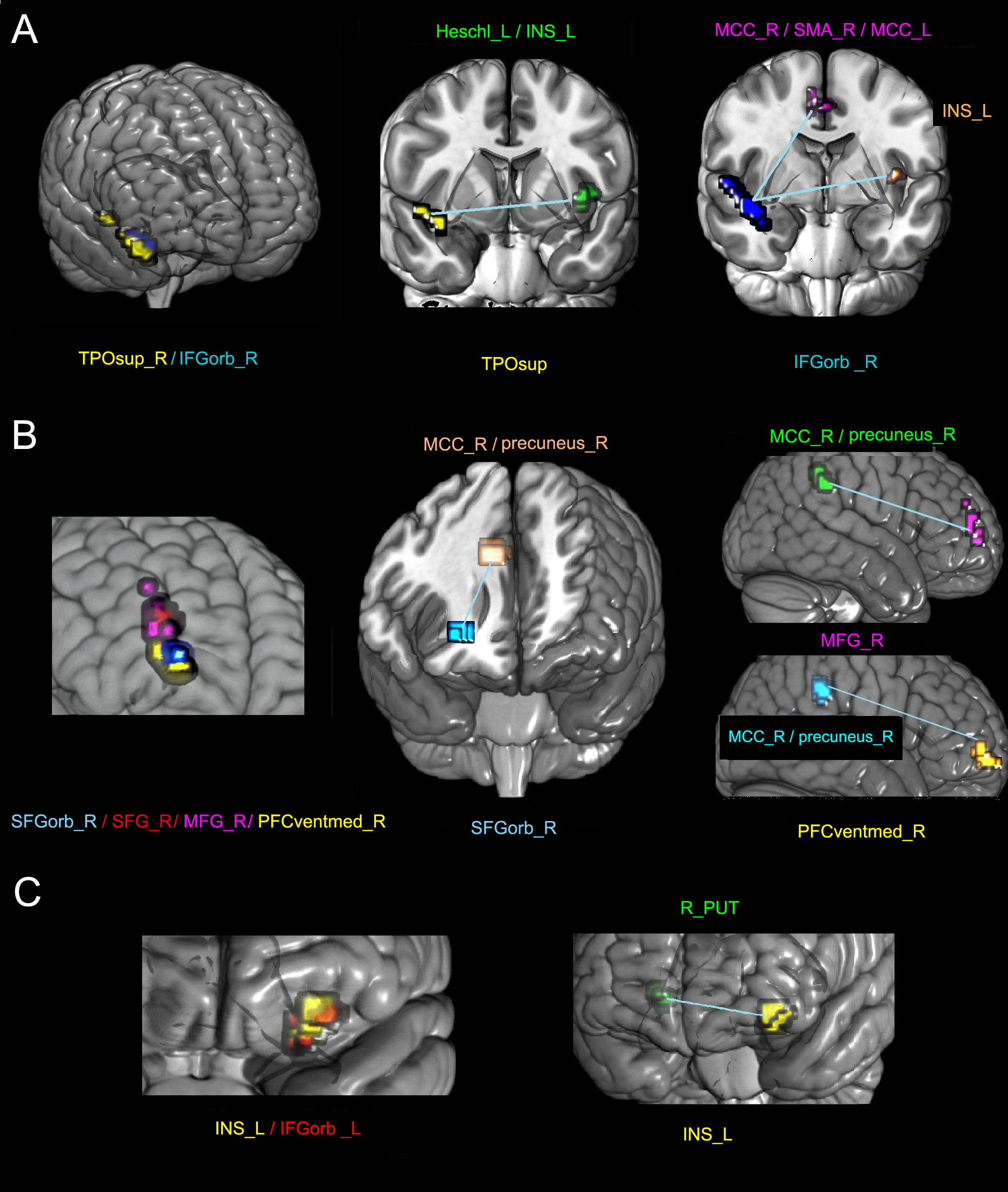 Frontiers  The brain-body disconnect: A somatic sensory basis for