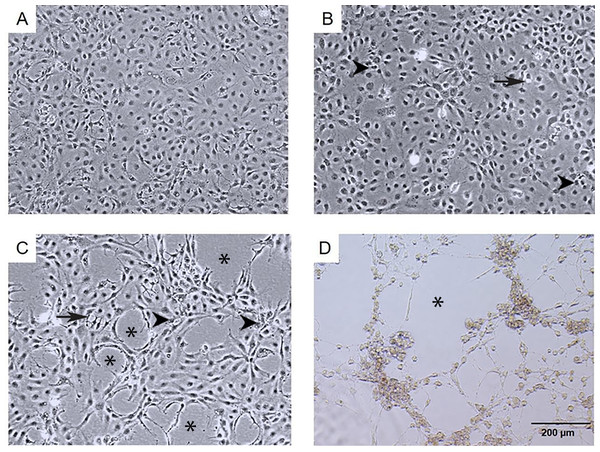 Morphological changes and cytopathic effects of TiLV infection in E-11 cells.