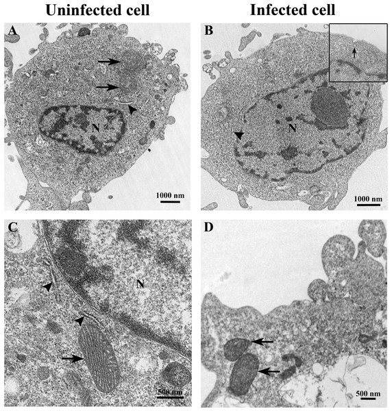 Representative TEM micrographs of uninfected and TiLV-infected E-11 cells at 0 dpi (1 h post-TiLV inoculation).