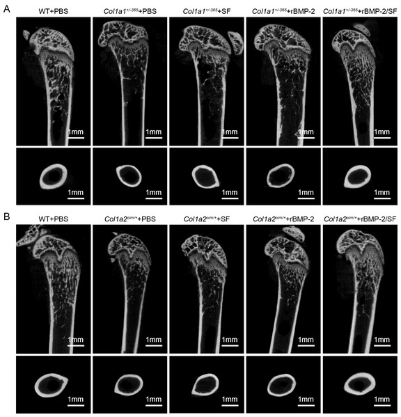 (A–B) Femoral Micro-CT detection 2 weeks after the final injection.