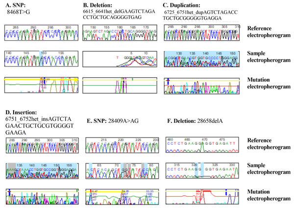 DNA sequence electropherograms demonstrating nucleotide mutations in the NOS3 and CTH genes.