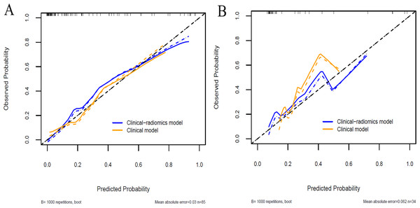 Calibration curves of the clinical model and the clinical-radiomics model in the training cohort (A) and validation cohort (B).