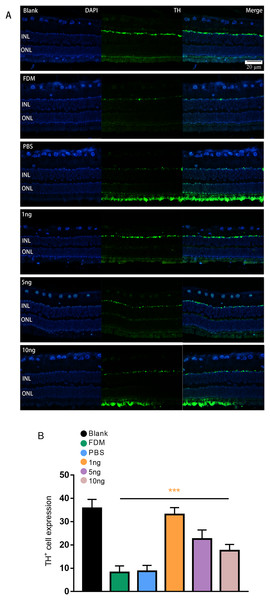 Significant changes in TH+ cells in the inner layer of the retina are observed under fluorescence microscopy.