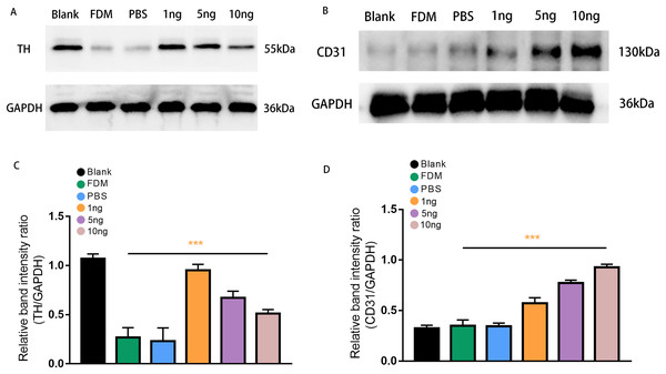 Expression of TH (A) and CD31 (B) proteins in the retinas of guinea pigs in each group.