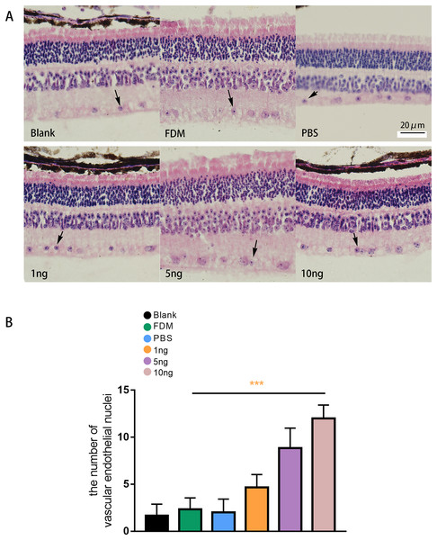 Changes in the number of nuclei of vascular endothelial cells in the retina of guinea pigs.