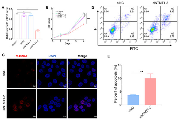 Effect of NTMT1 on HNSCC tumor cell.