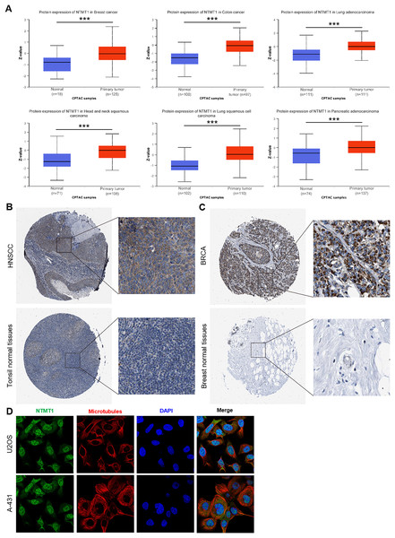 NTMT1 protein expression in various tumors.