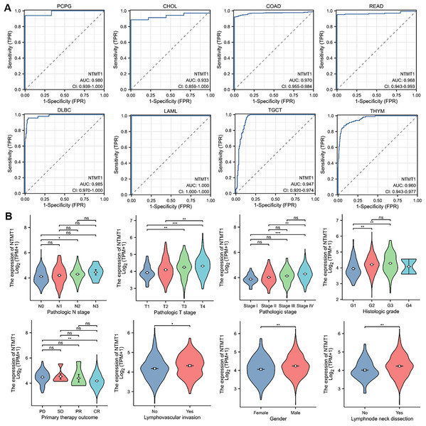 The correlation between NTMT1 gene expression and clinical characteristics.