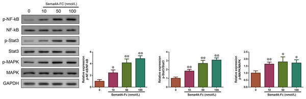 Sema 4A activated the NF-κB pathway in LC cells.