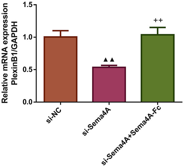 Sema4A upregulated PlexinB1 mRNA expression for LC cells.