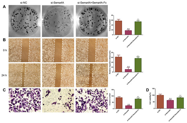 Sema4A promoted the growth and motility of LC cells.