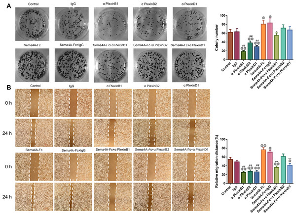 Sema4A facilitated the proliferative and migratory abilities of LC cells by upregulating PlexinB1.