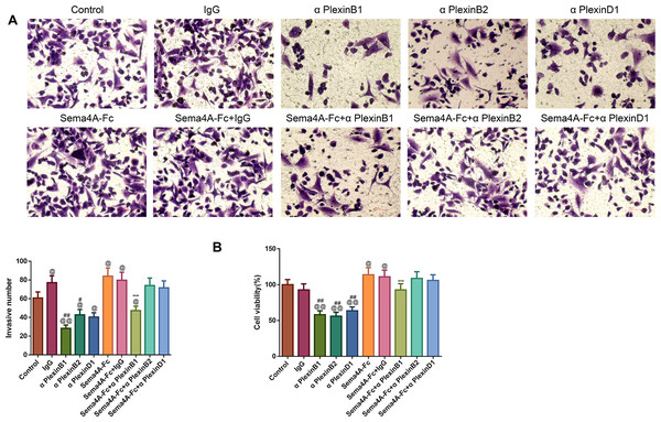 Sema4A facilitated the invasive ability and the viability of LC cells by upregulating PlexinB1.