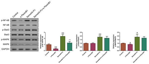 Sema4A promoted NF-κB, Stat3 and MAPK phosphorylation via upregulating PlexinB1 in LC cells.