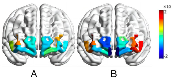 Activation map of HbO2 values of the map-characterized brain.