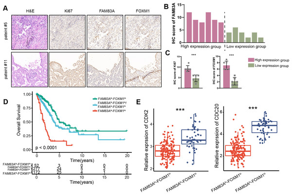 FAM83A/FOXM1 axis correlates with poor prognosis in LUAD.
