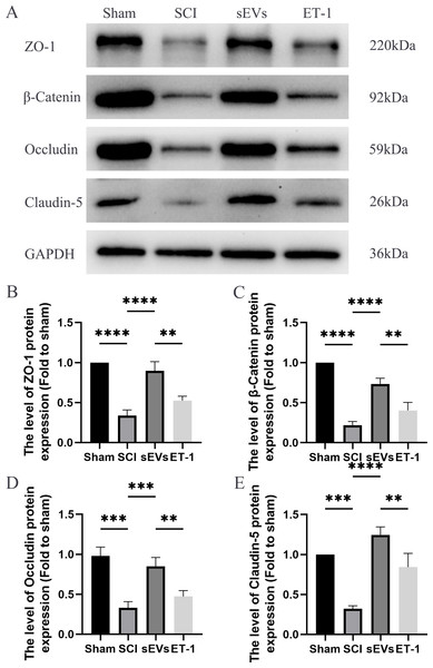 hUC-MSCs-sEVs increase the expression of junction proteins after SCI by down-regulation of ET-1.