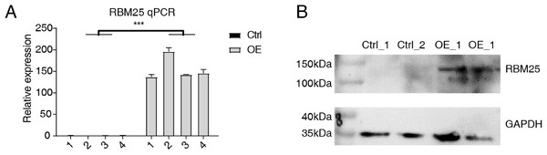 RBM25 overexpression in H9c2 cells.