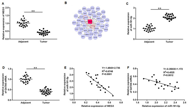 LncRNA MEG3/miR-181-5p/GATA6 was intimately related in PCa.