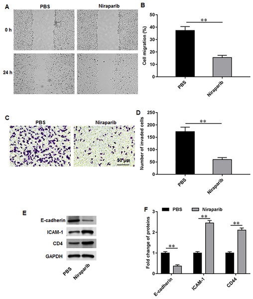 Niraparib treatment restrained PCa cell proliferation, migration and invasion.