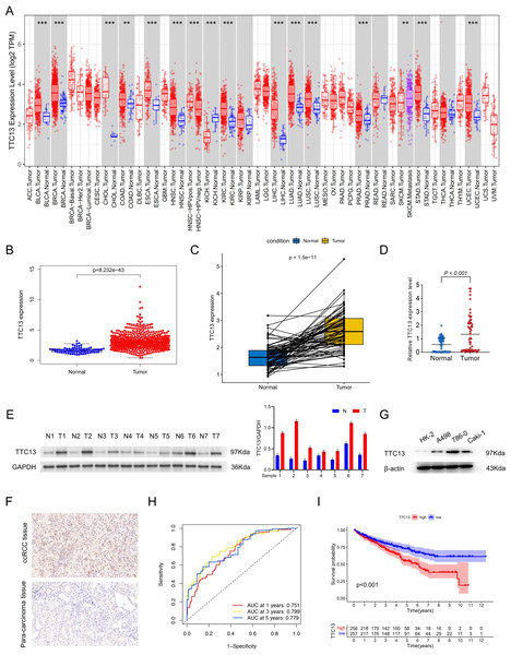 (A–I) Expression and clinical significance of TTC13 in ccRCC.