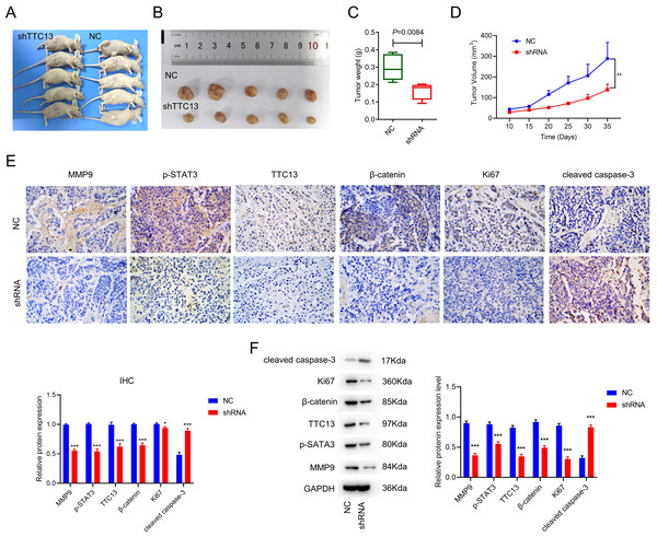 (A–F) TTC13 silencing inhibited tumor growth in vivo.