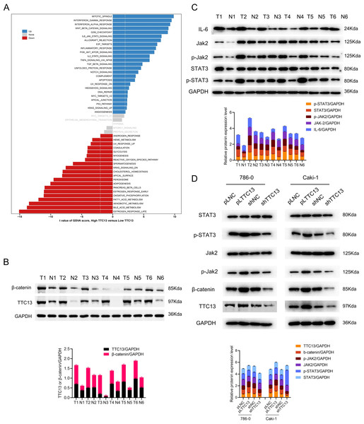 (A–D) TTC13 related signaling pathways in ccRCC.