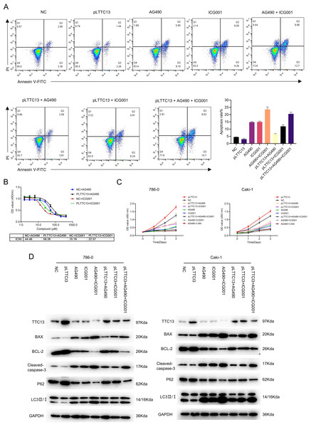 (A–D) TTC13 promoted ccRCC growth through Wnt/ β-catenin and IL6-JAK-STAT3 signal pathway.