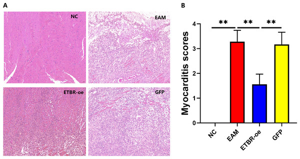 Effects of ETBR overexpression on inflammatory cell infiltration in EAM rats.