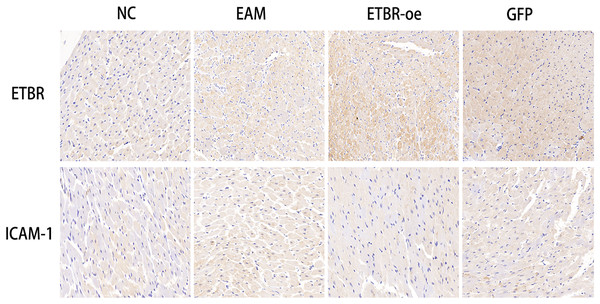 Distribution of ETBR and ICAM-1 proteins in myocardial tissue by immunohistochemical assay.