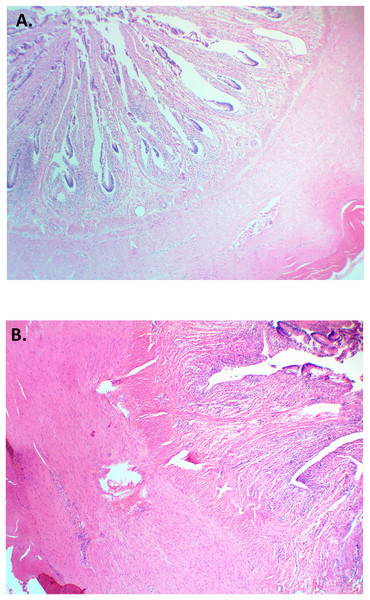 Histological cross-section of small intestine (jejunum) for American alligators fed (A) Animal Based Protein diet or (B) Soybean Meal Based Protein diet.