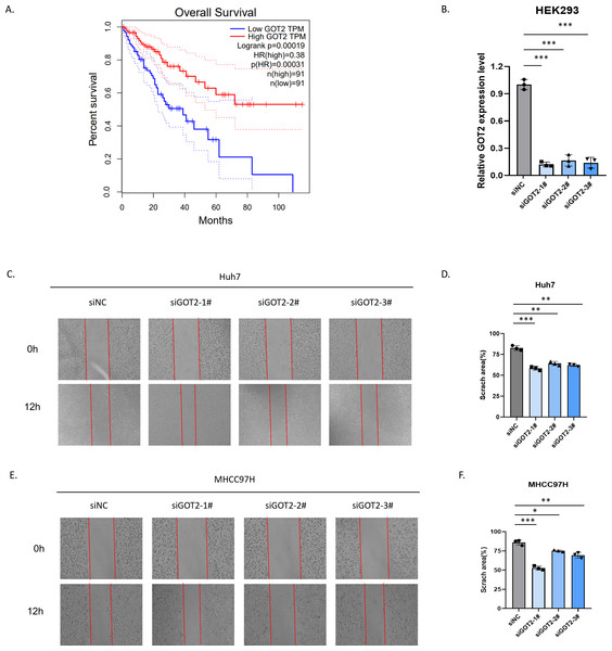 Decreased expression of GOT2 in hepatocellular carcinoma inhibits migration.
