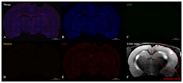 Histological images and MRI of the rat brain with experimental ischemic stroke 2 h after iNPCs IV transplantation.