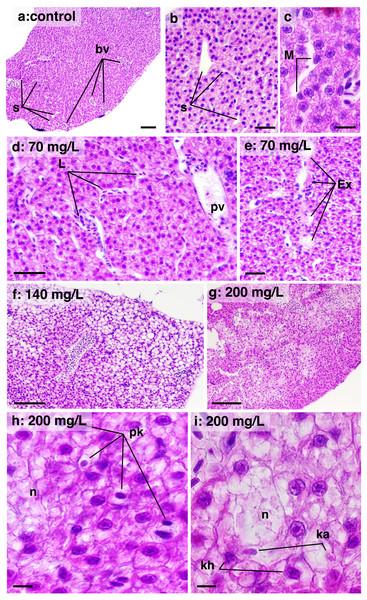 Histological sections of liver parenchyma in zebrafish adults exposed to 70, 140 and 200 mg/L of Chloramine-T for 96 h.