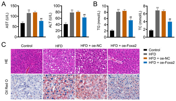 Foxa2 overexpression reduces hepatic steatosis in NAFLD mice.