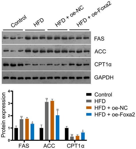 Foxa2 regulates hepatic lipid metabolism in NAFLD mice.