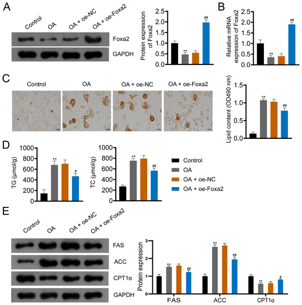 Foxa2 overexpression inhibits lipid accumulation in OA-induced HepG2 cells.