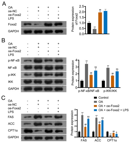 Foxa2 ameliorates hepatic steatosis via inhibiting NF-κb/IKK pathway.