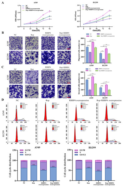 Overexpression of RBBP4 promotes the proliferation, migration and invasive ability of lung cancer cells and eliminates the antitumor effect of ropivacaine.