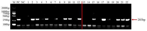 PCR detection results of tomato samples from the field and artificially inoculated samples.