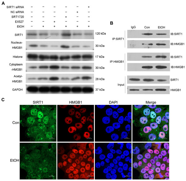 SIRT1 suppressed HMGB1 acetylation and nucleus-to-cytoplasm translocation.