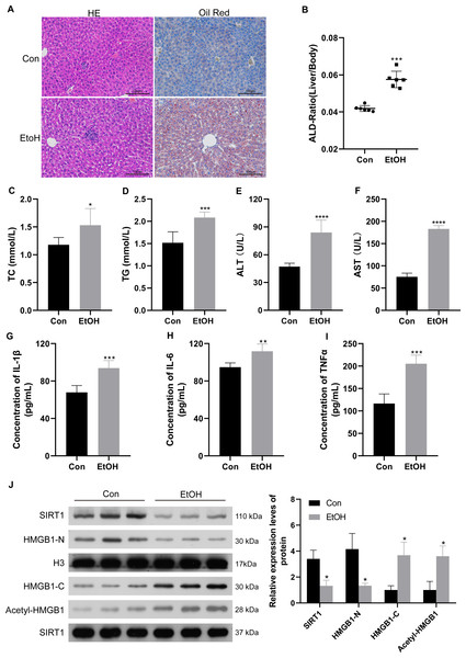 Low SIRT1 expression and HMGB1 acetylation and translocation were observed in C57BL/6 mice following ethanol treatment.